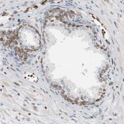 Immunohistochemistry-Paraffin: PRKAG2 Antibody [NBP1-89324]