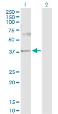 Western Blot: PRKAG2 Antibody [H00051422-D01P]