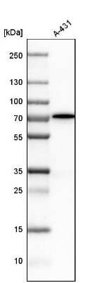 Western Blot: PRKAG2 Antibody [NBP1-89324]