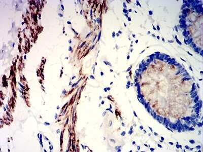 Immunohistochemistry: PRKAG3 Antibody (2C7A7) - BSA Free [NBP2-61796]