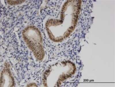 Immunohistochemistry-Paraffin: PRKCBP1 Antibody (5B12) [H00023613-M01]