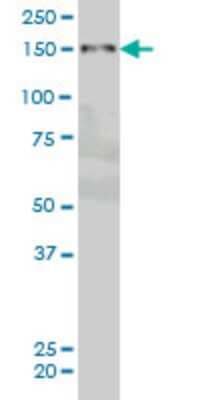 Western Blot: PRKCBP1 Antibody (5B12) [H00023613-M01]