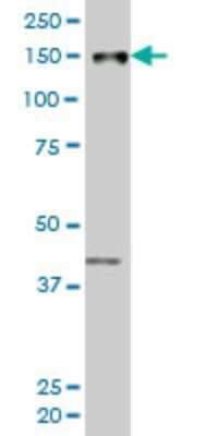 Western Blot: PRKCBP1 Antibody (6A12) [H00023613-M06]
