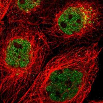 Immunocytochemistry/ Immunofluorescence: PRKCBP1 Antibody [NBP1-87227]