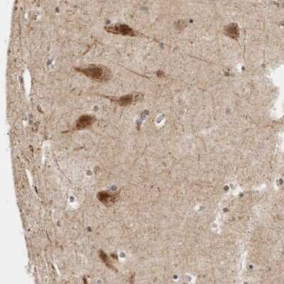 Immunohistochemistry-Paraffin: PRKCBP1 Antibody [NBP1-87227]