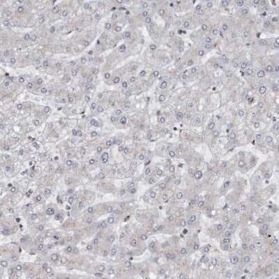 Immunohistochemistry-Paraffin: PRKCBP1 Antibody [NBP1-87227]