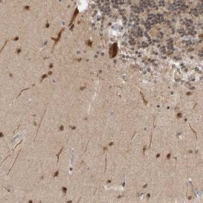 Immunohistochemistry-Paraffin: PRKCBP1 Antibody [NBP1-87227]
