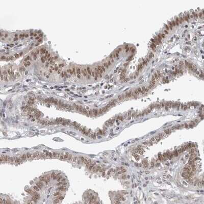 Immunohistochemistry-Paraffin: PRKCBP1 Antibody [NBP1-87227]