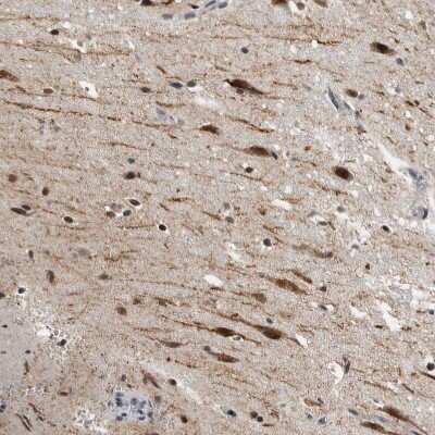 Immunohistochemistry-Paraffin: PRKCBP1 Antibody [NBP1-87227]
