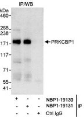 Immunoprecipitation: PRKCBP1 Antibody [NBP1-19131]