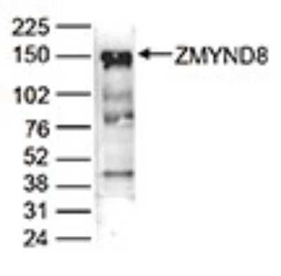 Western Blot: PRKCBP1 Antibody [NBP3-18649]