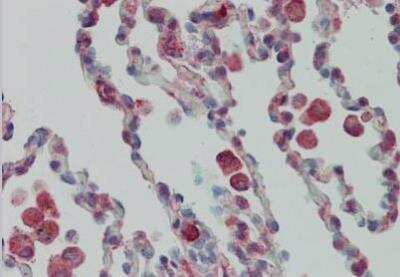 Immunohistochemistry: PRKCDBP Antibody [NBP1-44091]