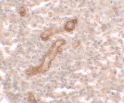 Immunohistochemistry: PRKCDBP Antibody - BSA Free [NBP2-81847]