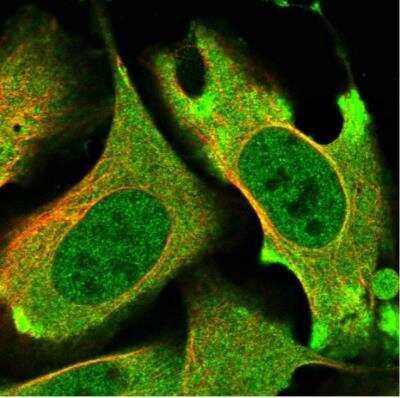 Immunocytochemistry/ Immunofluorescence: PRKD3/nPKC nu Antibody [NBP1-87948]