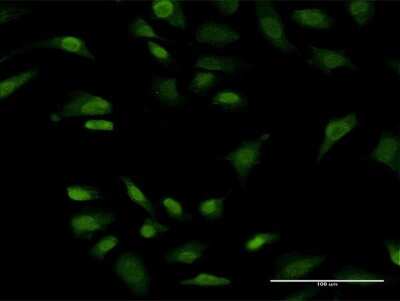 Immunocytochemistry/ Immunofluorescence: PRKRIP1 Antibody (4D11-3F11) [H00079706-M05]