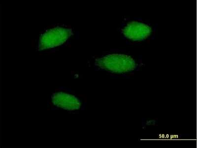 Immunocytochemistry/ Immunofluorescence: PRKRIR Antibody [H00005612-B01P]