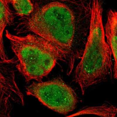 Immunocytochemistry/ Immunofluorescence: PRKRIR Antibody [NBP1-85312]