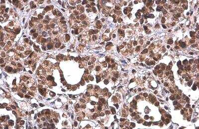 Immunohistochemistry-Paraffin: PRMT1 Antibody (10111) [NBP2-43818]