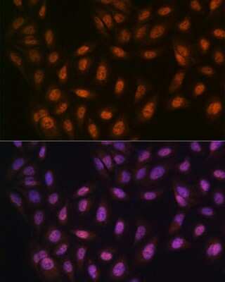 Immunocytochemistry/ Immunofluorescence: PRMT1 Antibody (10W10U4) [NBP3-16423]