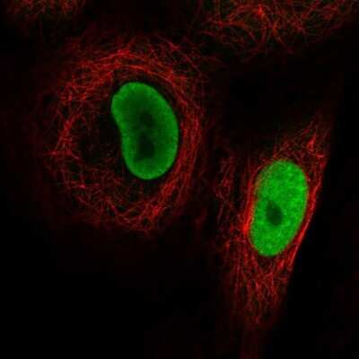 Immunocytochemistry/ Immunofluorescence: PRMT1 Antibody [NBP2-58031]