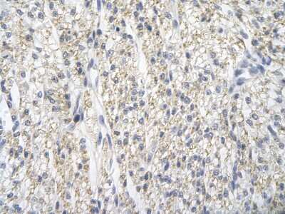 Immunohistochemistry: PRMT2 Antibody [NBP1-52944]
