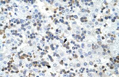 Immunohistochemistry-Paraffin: PRMT2 Antibody [NBP1-52944]