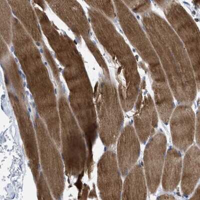 Immunohistochemistry-Paraffin: PRMT2 Antibody [NBP1-83206]