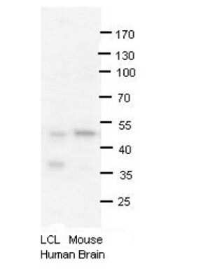 Western Blot: PRMT2 Antibody [NBP1-52944]