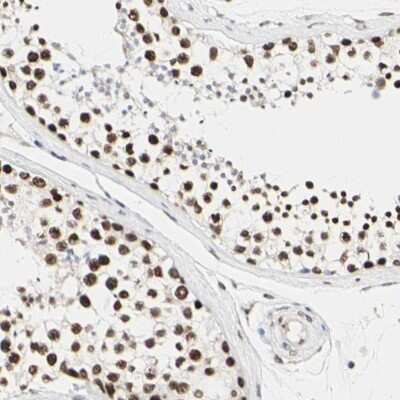 Immunohistochemistry-Paraffin: PRMT3 Antibody [NBP1-83205]