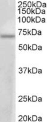 Western Blot: PRMT3 Antibody [NBP2-26133]