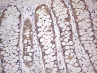 Immunohistochemistry: PRMT5 Antibody (OTI2H3) [NBP2-45394]