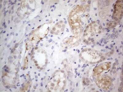 Immunohistochemistry: PRMT5 Antibody (OTI2H3) [NBP2-45394]