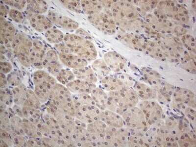 Immunohistochemistry: PRMT5 Antibody (OTI2H3) [NBP2-45394]