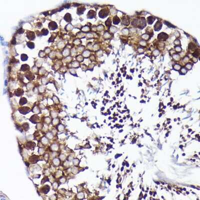 Immunohistochemistry-Paraffin: PRMT5 Antibody (7K2G5) [NBP3-15758]