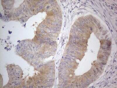 Immunohistochemistry: PRMT5 Antibody (OTI2H3) - Azide and BSA Free [NBP2-73604]
