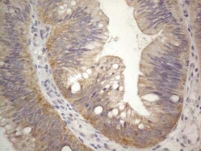 Immunohistochemistry: PRMT5 Antibody (OTI2H3) - Azide and BSA Free [NBP2-73604]