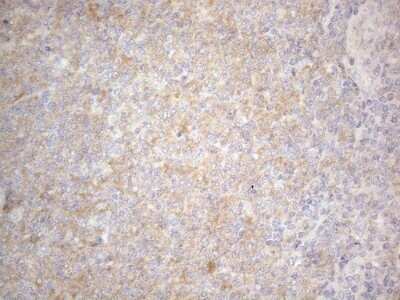 Immunohistochemistry: PRMT5 Antibody (OTI2H3) - Azide and BSA Free [NBP2-73604]