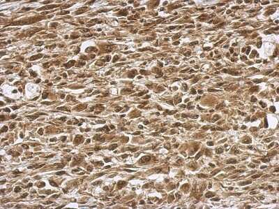 Immunohistochemistry-Paraffin: PRMT7 Antibody [NBP2-19939]