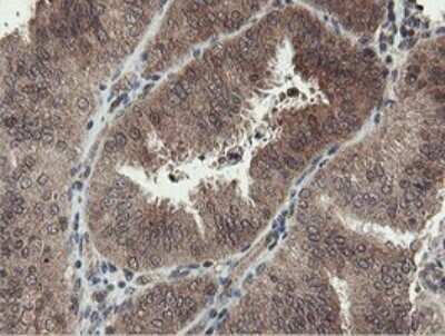 Immunohistochemistry: PROSC Antibody (OTI3G7) [NBP2-45396]