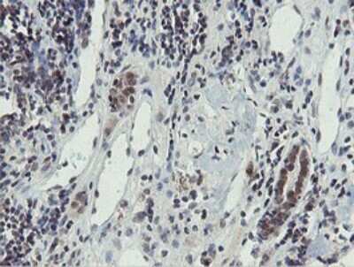 Immunohistochemistry: PROSC Antibody (OTI3G7) [NBP2-45396]