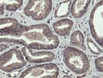 Immunohistochemistry: PROSC Antibody (OTI3G7) [NBP2-45396]