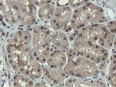 Immunohistochemistry: PROSC Antibody (OTI3G7) [NBP2-45396]
