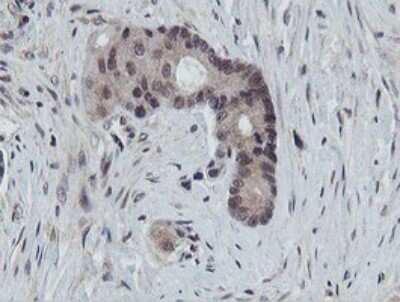 Immunohistochemistry: PROSC Antibody (OTI3G7) [NBP2-45396]
