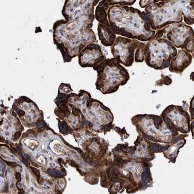 Immunohistochemistry-Paraffin: PROSC Antibody [NBP1-85989]