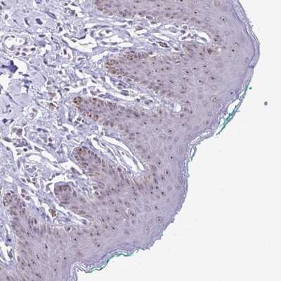 Immunohistochemistry: PROSER1 Antibody [NBP2-37949]