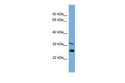 Western Blot: PROSER2 Antibody [NBP2-83421]