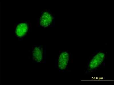 Immunocytochemistry/ Immunofluorescence: PRP18 Antibody [H00008559-B02P]