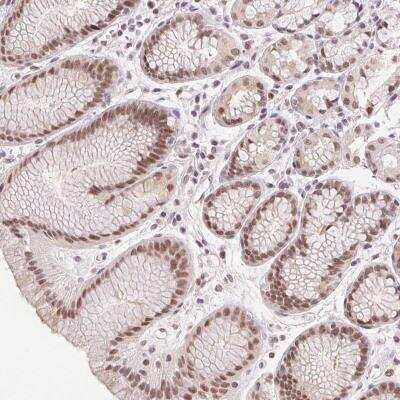 Immunohistochemistry: PRP18 Antibody [NBP2-46757]