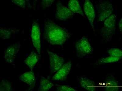 Immunocytochemistry/ Immunofluorescence: PRP19 Antibody (2E5) [H00027339-M07]