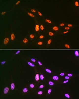 Immunocytochemistry/ Immunofluorescence: PRP19 Antibody (4M3Z1) [NBP3-16853]